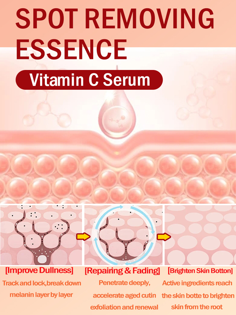 Ilumine sardas melasma, mancha - Skincare Luxury Whitening avaliação e preço