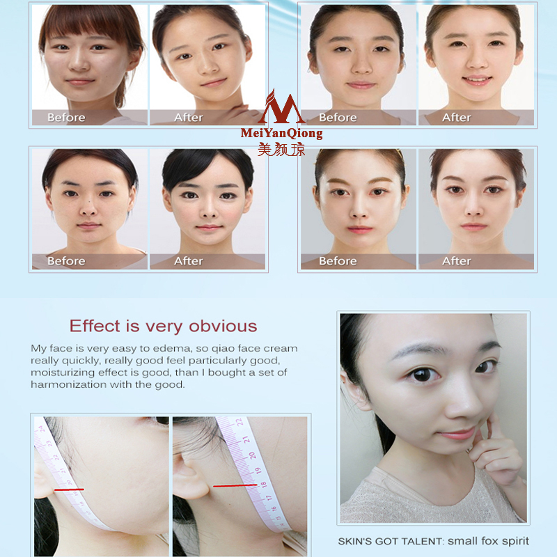 Face Levantamento Moldar Cuida - Luxury Skincare China avaliação e preço